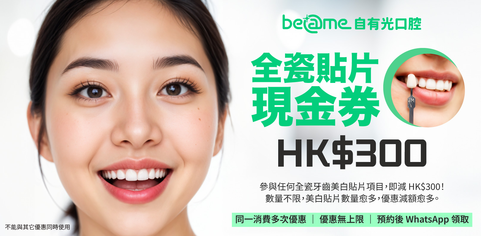 凡光顧美白牙貼服務，出示現金券每顆牙貼即可享扣減 HK$300。同一消費可多次使用美白牙貼優惠。只要完成網上預約深圳自有光門診，即可向客服領取全瓷美白牙貼現金券。